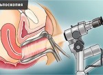 Кольпоскопия шейки матки